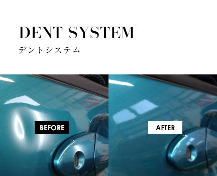 DENT SYSTEM デントシステム